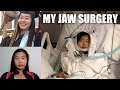 MY JAW SURGERY EXPERIENCE | LeFort I Osteotomy Day 1-35 of Recovery & Tips (VLOG 11) | katyyho