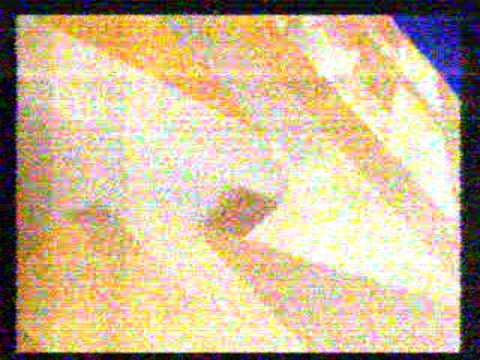 B-Channel 310109