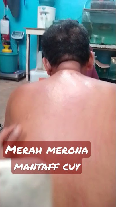 pijat mencret kena masuk angin#shorts