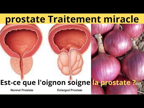 Here&rsquo;s how to maintain the prostate with onion