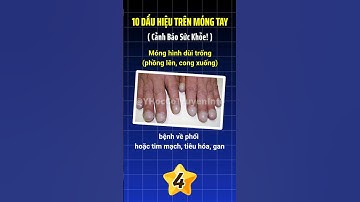 Nhìn Móng Tay, Đọc Vị Sức Khỏe Của Bạn (Bạn Sẽ Bất Ngờ!) #yhoccotruyen #mongtay #dauhieubenh