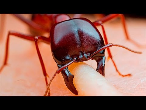 Укусы муравьев лечение в домашних условиях