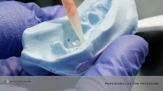 See the Provisional Procedure of a Single-Unit Crown Dental Restoration | Dentsply Sirona
