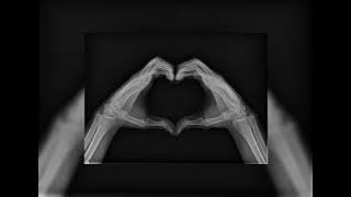 Zara larsson - lush life (sped up)