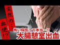 突然の血便、実は大腸憩室出血かも⁉️その怖い実態とは?【消化器専門医解説】