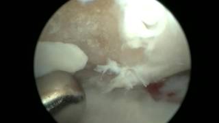 РОХ медиального мыщелка плечевой кости, собака  www.endovet.com