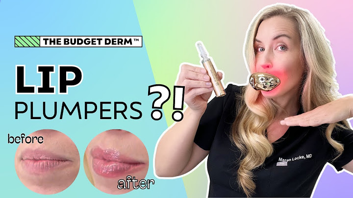 Plump Lips WITHOUT Lip Filler?! | My Before + After Results