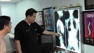 Gas pain, trapped gas, magenblase syndrome - FIXED with Gonstead Chiropractic