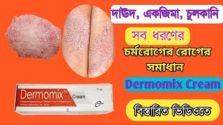 দাদ ও চুলকানি দূর করার উপায় | Dermomix cream | Fungal Infection | Tinea Corporis