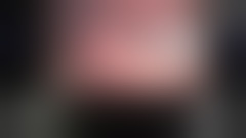 Robotic Partial Nephrectomy - Step 5: Tumor Identification and TilePro