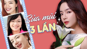 ✌️ Kinh nghiệm SỬA MŨI của Emmi | Thực sự CÓ NÊN NÂNG MŨI? 🤔