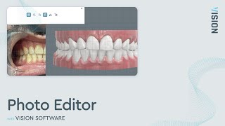 Photo Editor Feature | Orthodontic Imaging Software screenshot 1