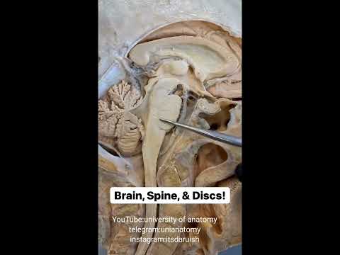 آناتومی ساقه مغز برروی جسد   ساقه مغز به شکل واقعی چگونه است