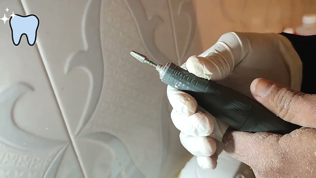 Grattage appareil prothèse dentaire et finition