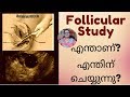 Follicular Study - What Is It? Why Is It Done? എന്താണ് ? എന്തിനു ചെയ്യുന്നു?