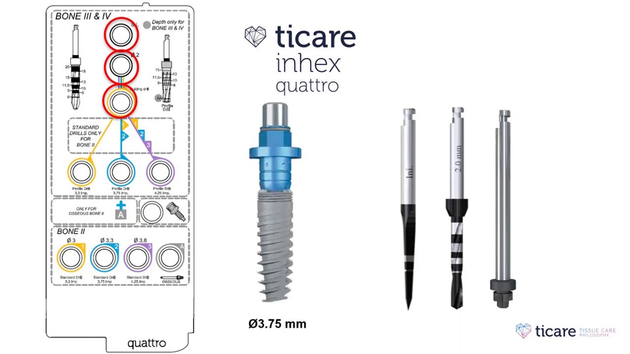 Ticare Inhex Quattro Implants | Drilling sequence - YouTube