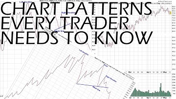 5 CHART PATTERNS EVERY TRADER NEEDS TO KNOW 📈