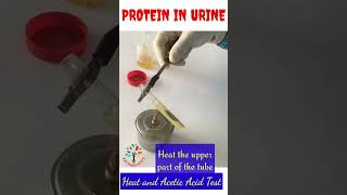 Protein in Urine ll Heat and Acetic acid test ll #shorts