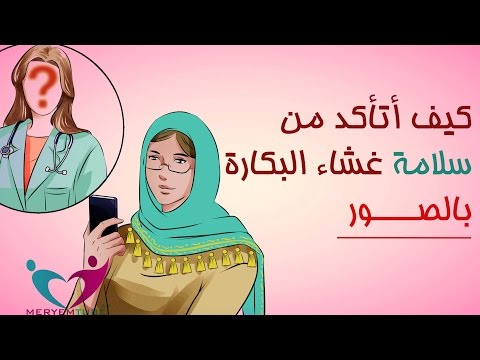 فيديو: كيف تتأكد من حالتك كأم عزباء