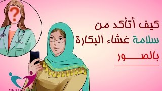 كيف اعرف اني عذراء بالصور