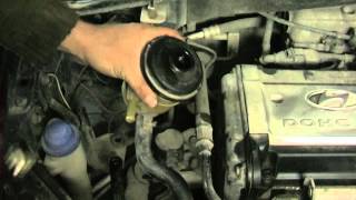 Замена жидкости ГУР Hyundai Getz(, 2015-03-05T10:35:33.000Z)