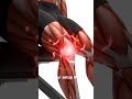 Leg Press Knee Pain? Fix Your Foot Position