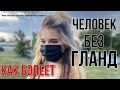 ТОНЗИЛЛЭКТОМИЯ КАК Я БОЛЕЮ БЕЗ ГЛАНД?