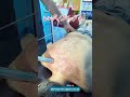 ⚡ Advanced Shockwave Therapy for Back Pain