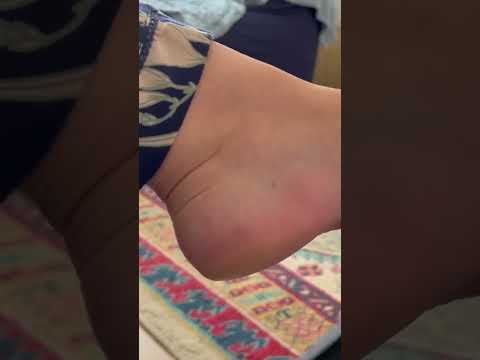 Thin flip flop slapping