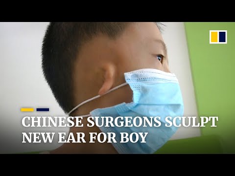 Life-changing surgery gives new ear to Chinese boy with the congenital deformity microtia