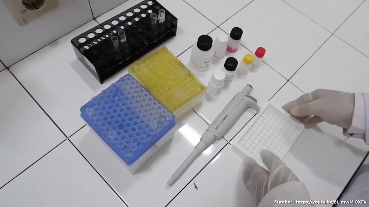 PEMERIKSAAN HBsAg METODE ELISA [ PERTEMUAN 13 ]