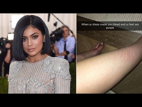 Kylie Jenner's Met Gala Outfit Made Her Bleed?!