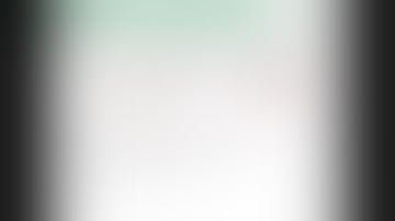 Laparoscopic 95% Near Total Gastrectomy for Gastric Cancer:    Standardized Technique