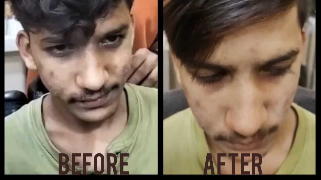 HAIR REBOUNDING BY REVIVE MEN SALON💯 ️ - YouTube