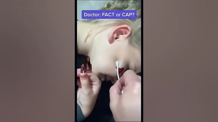 Can a Q-Tip Really Do This To Your Ear? FACT or CAP?