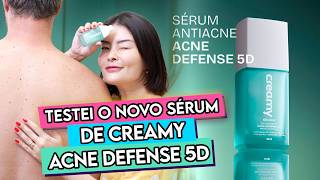 SE VOCÊ TEM ACNE, PRECISA VER ISSO! (Testei nas costas do morzi)