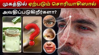 முகத்தில் தடிப்புத் தோல் அழற்சியுடன் போராடுகிறீர்களா? | Struggling with face psoriasis?