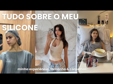 Everything About My Breast Implants | Size, Surgery + Experience