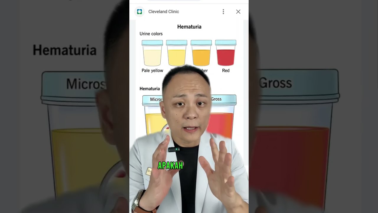 Tahap-tahap penyakit buah pinggang kronik (Chronic Kidney Disease CKD)