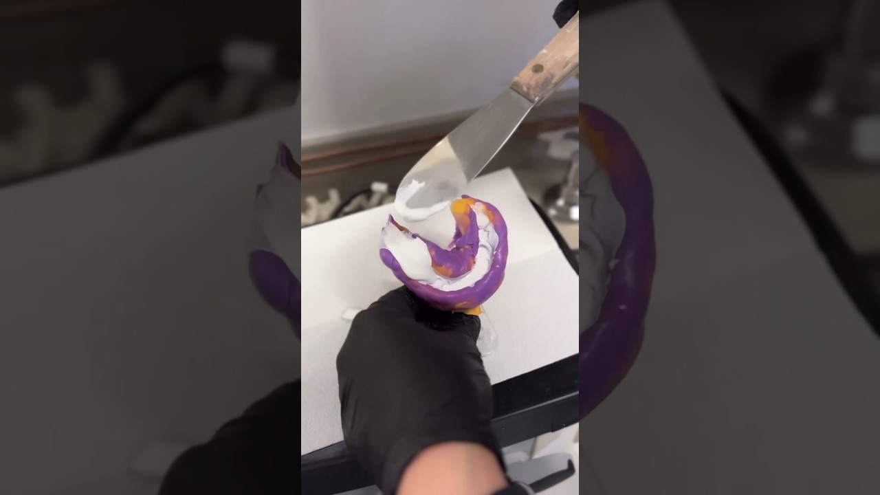 Pouring a PVS Impression #dentist #dentalprocedure #digitaldentistry