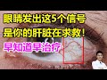 眼睛发出这5个信号，是你的肝脏在求救！早知道早治疗丨李医生谈健康【中医养生】