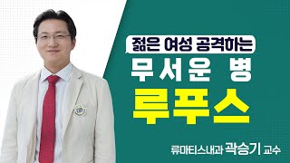[서울성모병원] 젊은 여성 공격하는 무서운 병  '루푸스'   류마티스내과 곽승기 교수