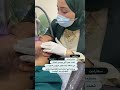 سكارليت نضاره البشره تجميل ليزر سكلبترا تصبغات فراكشنال عيادات تجميل عيادات الماسي