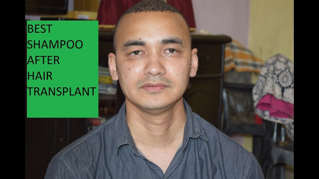 Hair transplant in india (2018) Best Shampoo Johnson baby shampoo