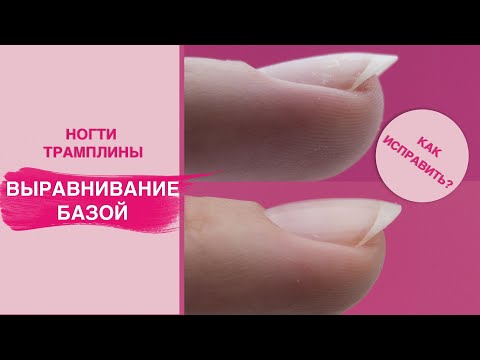 ВЫРАВНИВАНИЕ НОГТЕВОЙ пластины
