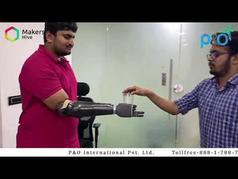KalArm (India’s First functional bionic hand)