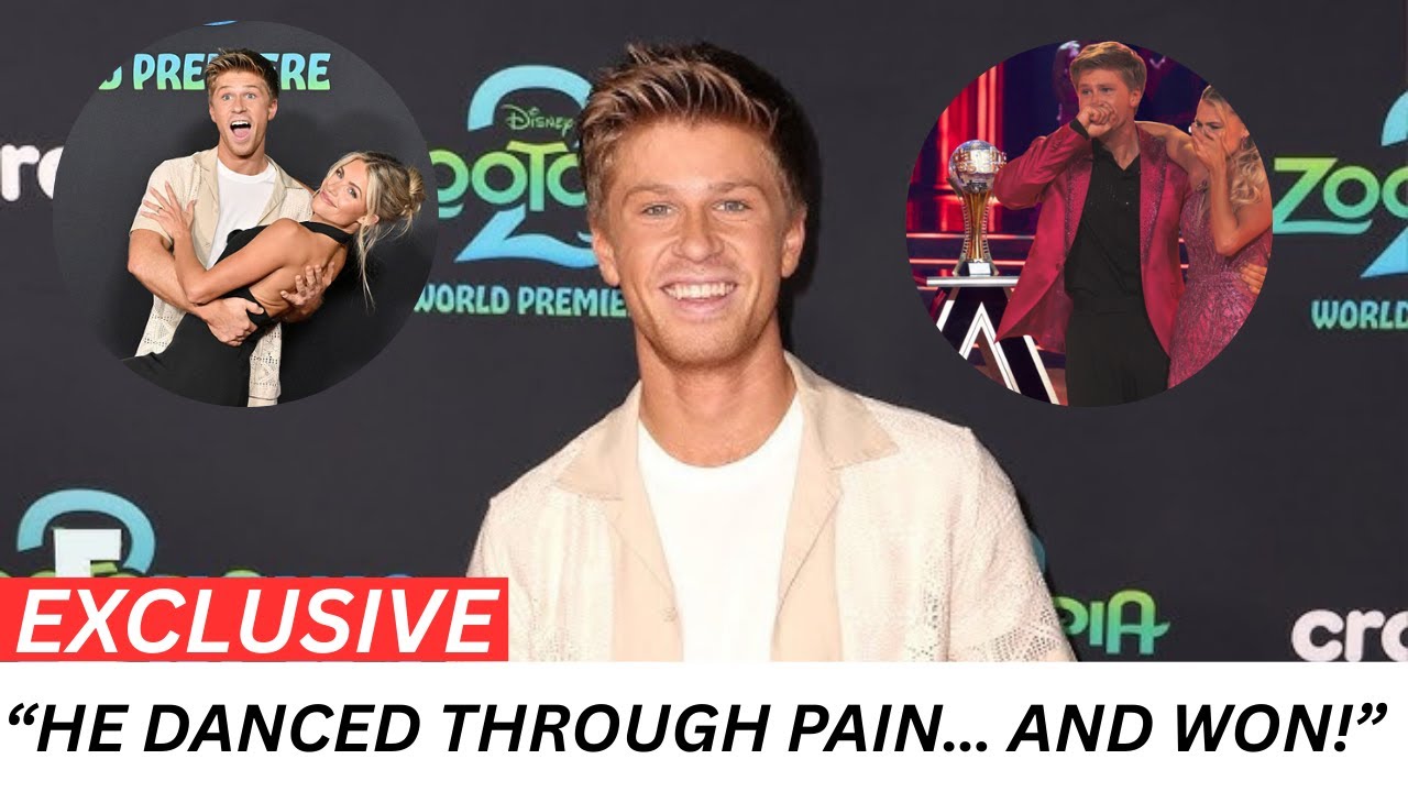Dancing With the Stars' Robert Irwin Shares Update on “Painful” Rib ...