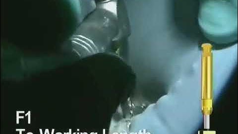 How to Use Protaper Rotary File Clinically | pinkblue