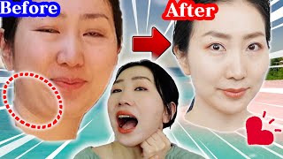 Remove Jaw Fat by Sticking your Fist under your Jaw and Tighten up Jaw Line