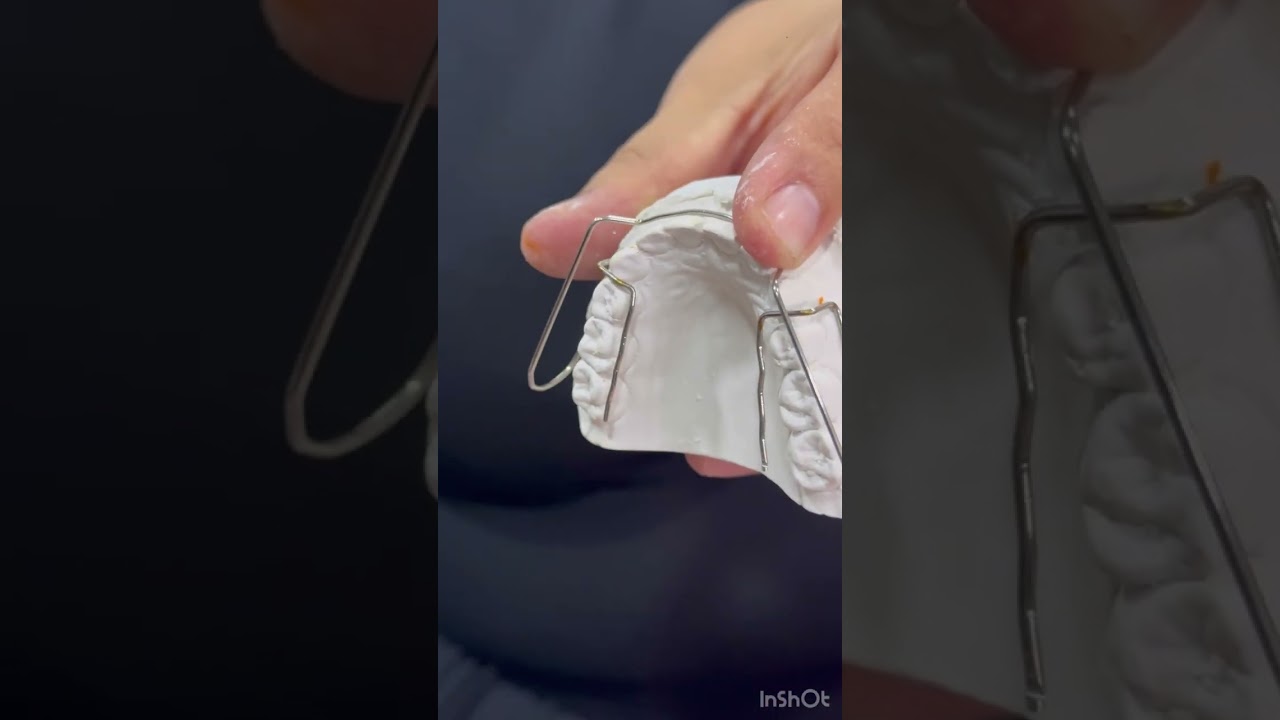 FABRICACIÓN DEL APARATO BIONATOR